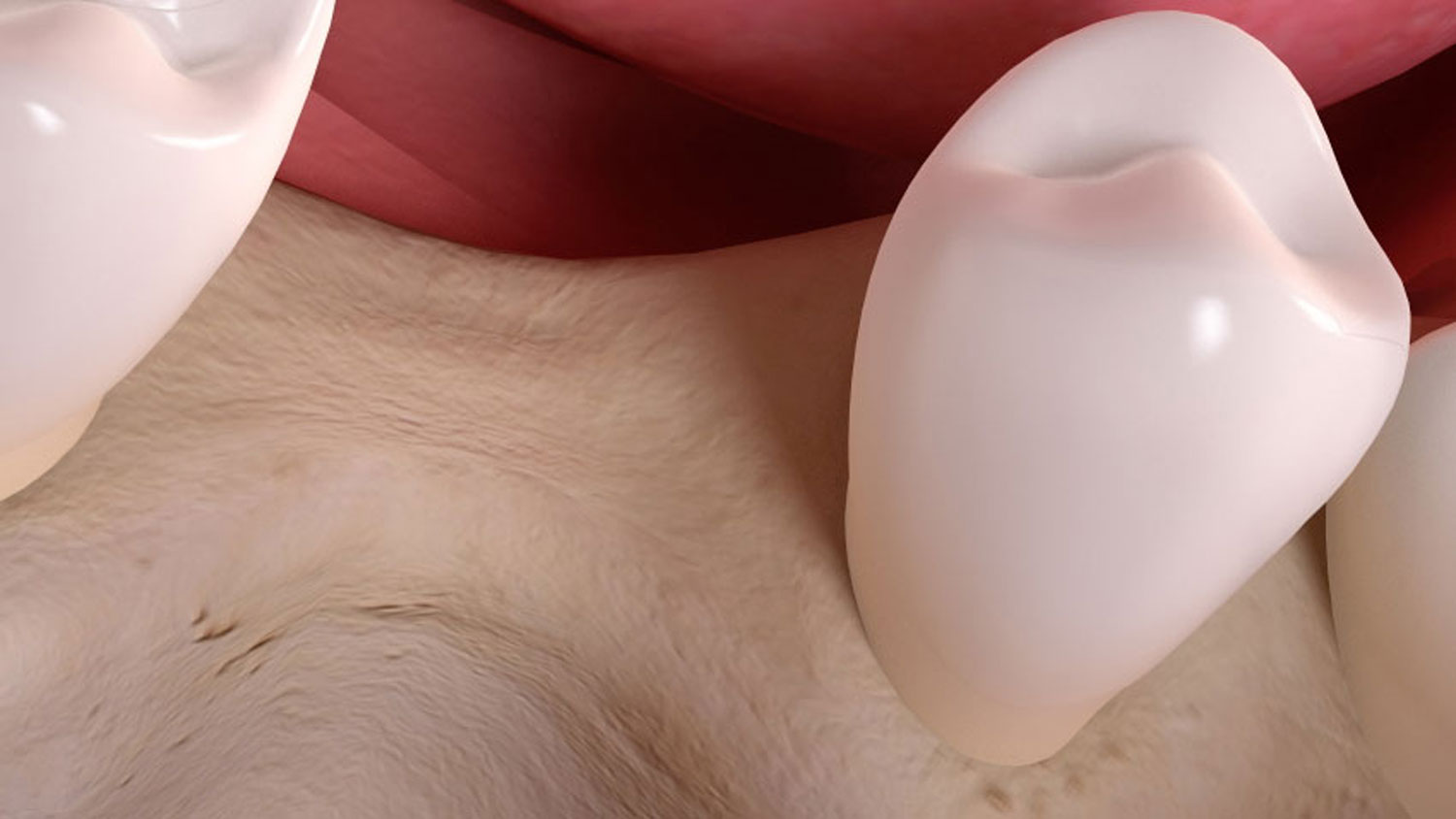 In einem persönlichen Beratungsgespräch werden immer alle Behandlungsschritte eines Knochenaufbaus genauestens mit Ihnen abgestimmt. Je nach Ihrer individuellen Situation werden wir uns gemeinsam für das beste Vorgehen entscheiden.